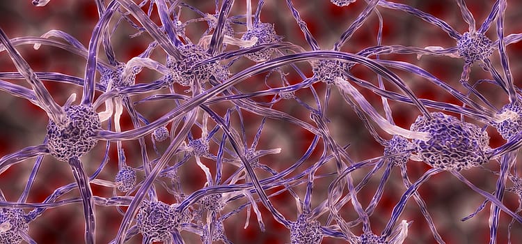 Beginner’s Guide To Nerve Pain Relieve
